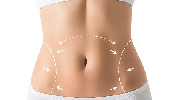 Abdominoplastia: saiba tudo sobre a cirurgia plástica