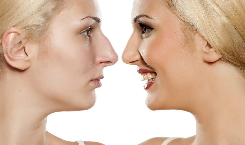 Rinoplastia estruturada x redutora – Qual a diferença?