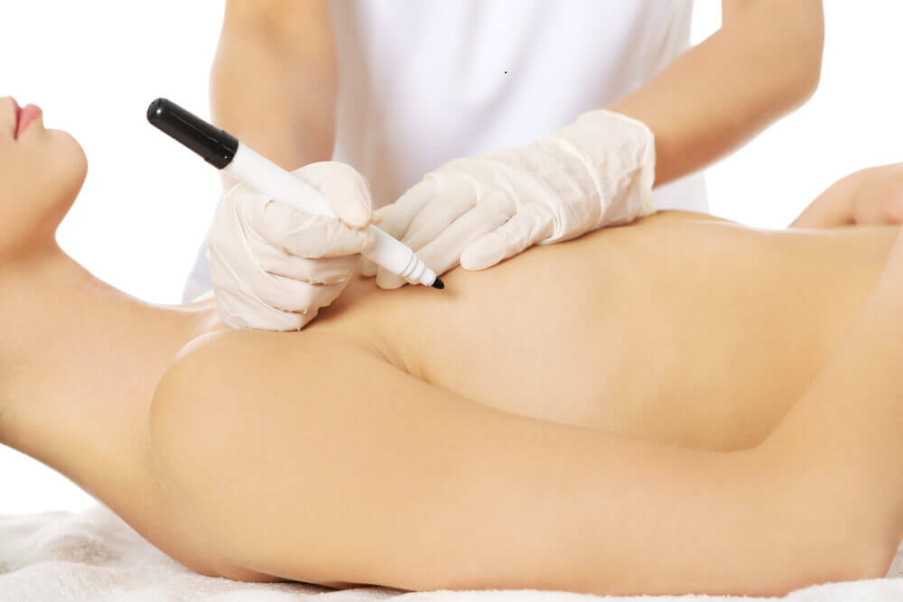 Conheça os diferentes tipos de mamoplastia