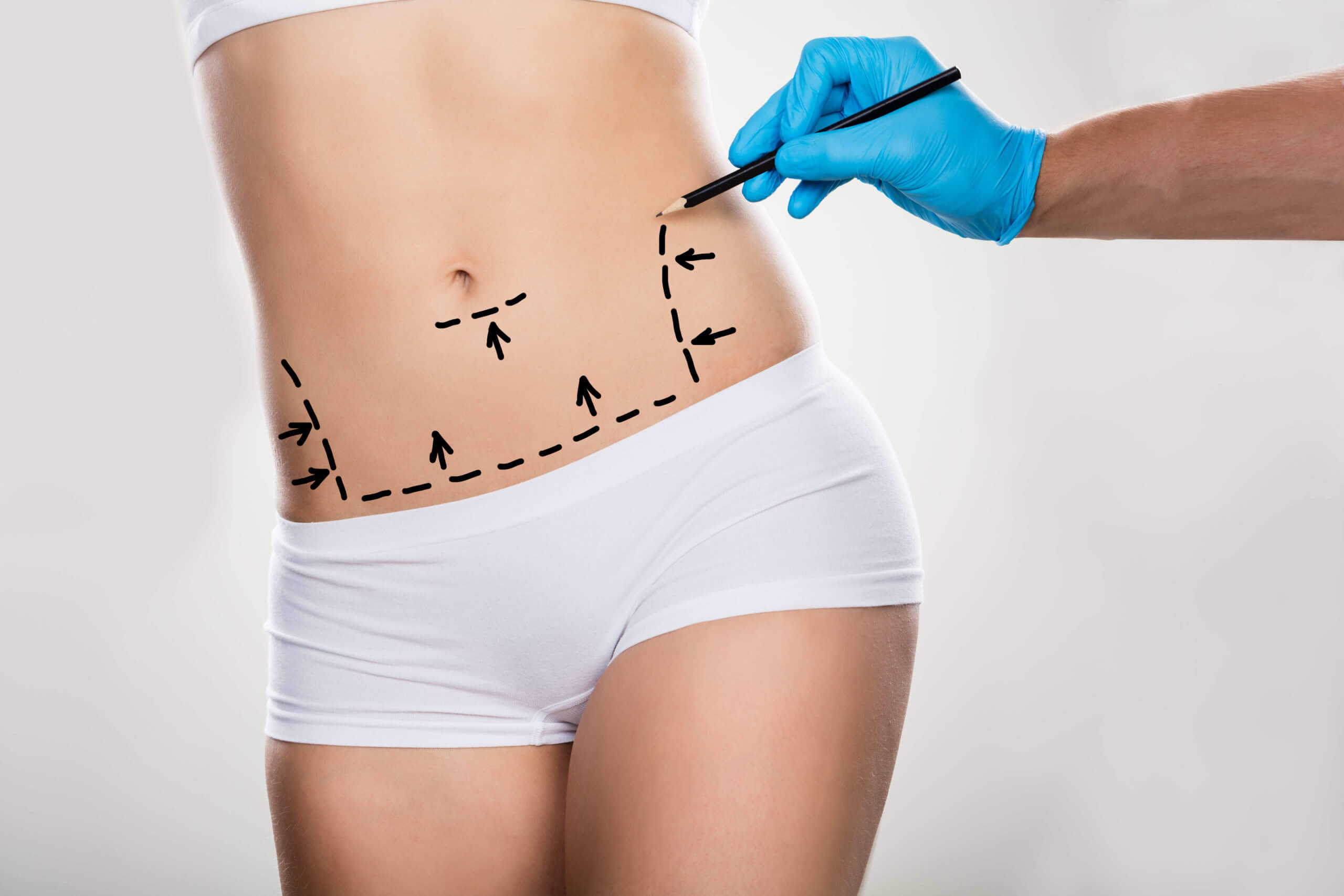 Como se preparar para a abdominoplastia?