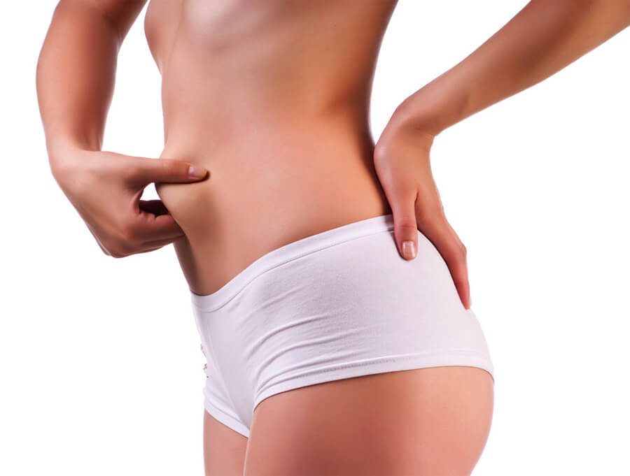 Antes e depois de uma cirurgia de lipoaspiração