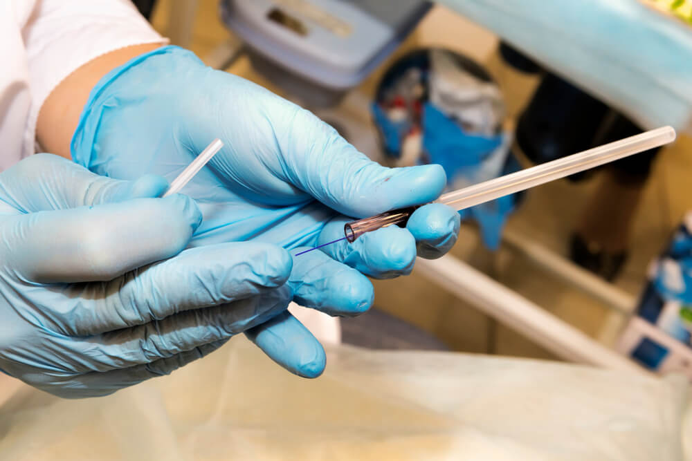 Procedimentos mais comuns feitos por um cirurgião plástico