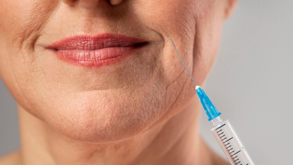 Cuidados após o preenchimento do bigode chinês