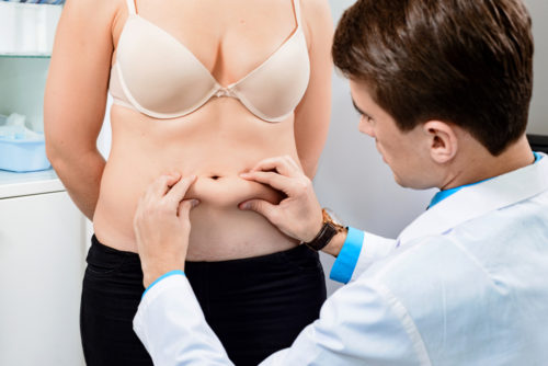 Consulta com cirurgião plástico para realização de uma abdominoplastia