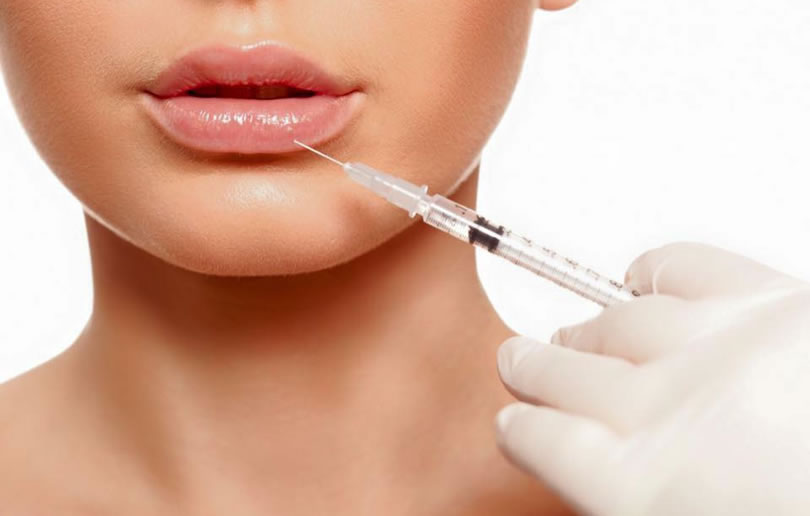 Aplicação de ácido hialurônico no preenchimento labial