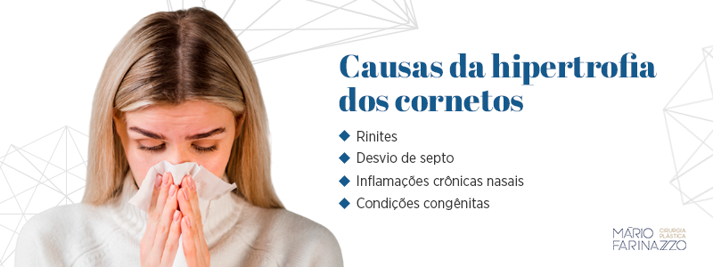 Causas da hipertrofia dos cornetos
Rinites
Desvio de septo
Inflamações crônicas nasais
Condições congênitas