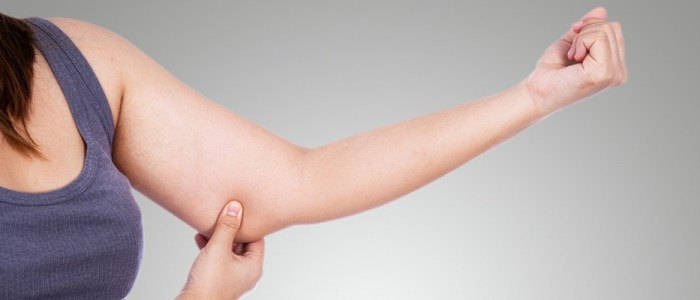 Lipoaspiração nos braços