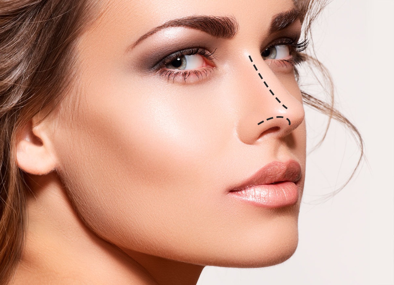 A queda do nariz fino e arrebitado como padrão e anseio geral: tendência agora é a naturalidade