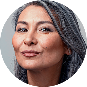 Ritidoplastia, Lifting Facial ou Deep Plane