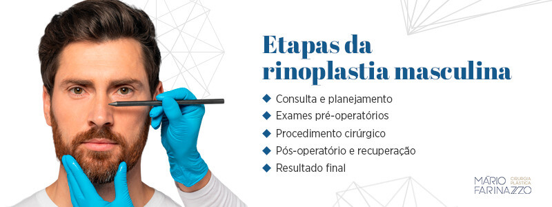 Etapas da rinoplastia masculina: consulta e planejamento, exames pré-operatórios, procedimento cirúrgico, pós-operatório e recuperação e resultado final.