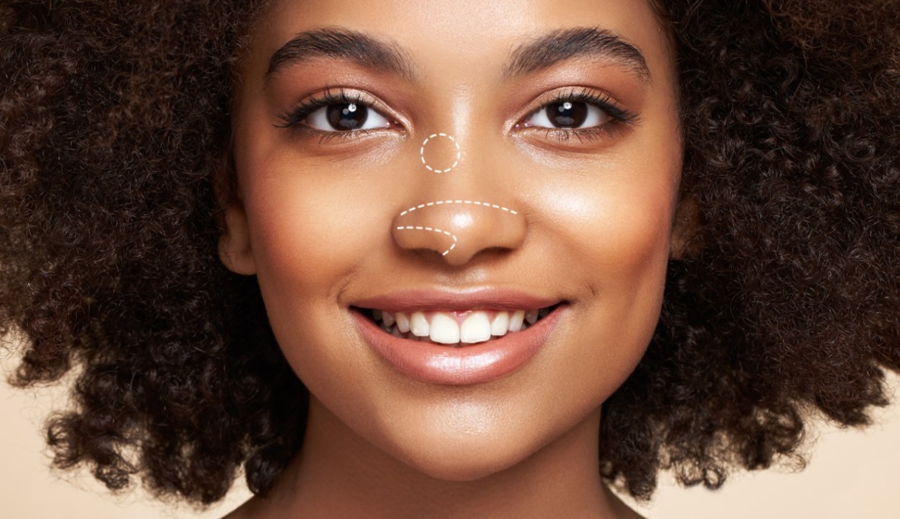 Quais procedimentos que podem ser realizados juntos com a rinoplastia?