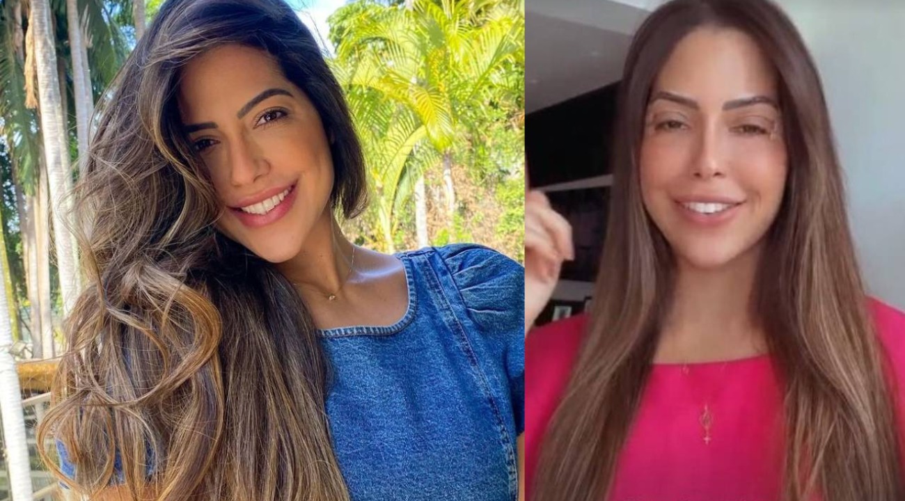 Blefaroplastia: Laís Caldas passa por cirurgia para ‘corrigir’ olhos caídos