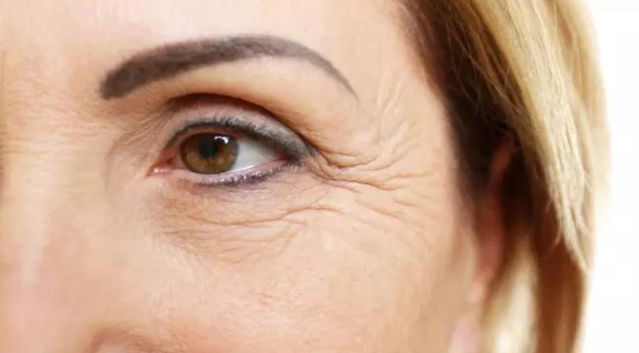 Rugas, marcas e mais: como tratar 9 alterações estéticas comuns