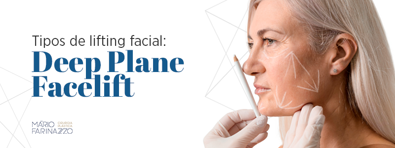 Tipos de lifting facial Deep Plane Facelift