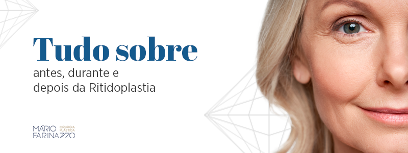 Tudo sobre antes, durante e depois da Ritidioplastia.