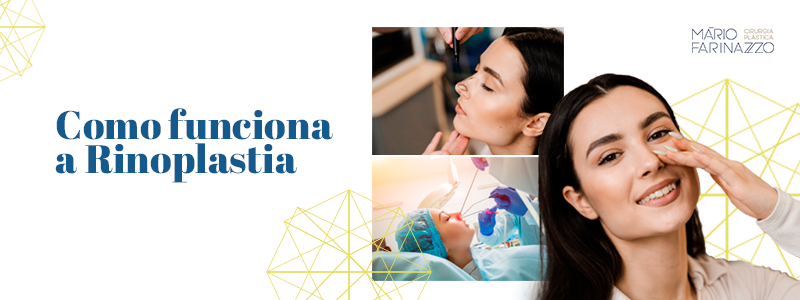 Como funciona a Rinoplastia?