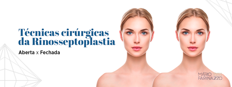 Técnicas cirúrgicas da Rinosseptoplastia: aberta ou fechada.