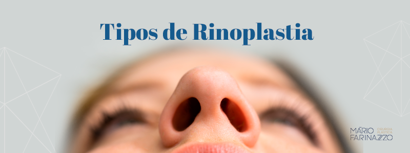 Tipos de Rinoplastia.
