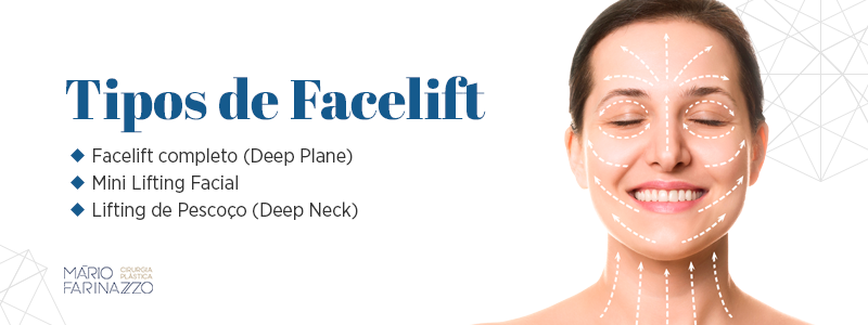Tipos de Facelift; Facelift completo (Deep Plane), Mini Lifting Facial, e Lifting de Pescoço (Deep Neck).
