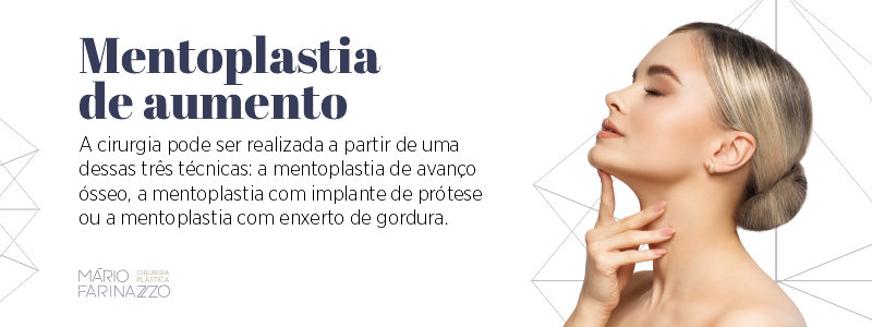 Mentoplastia de aumento.
A cirurgia pode ser realizada a partir de uma dessas três técnicas: a mentoplastia de avanço ósseo, a mentoplastia com implante de prótese ou a mentoplastia com enxerto de gordura.