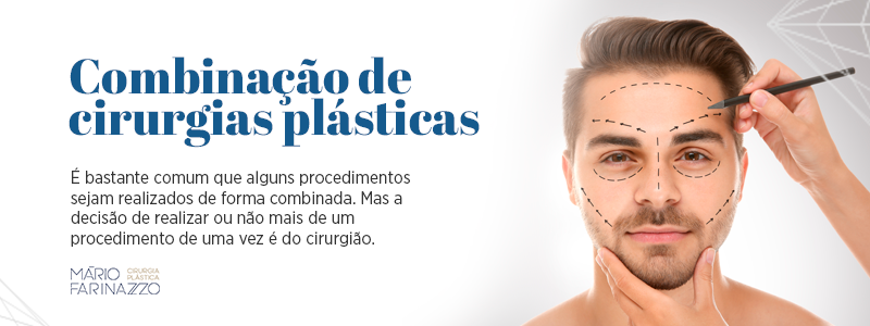 Combinação de cirurgias plásticas: É bastante comum que alguns procedimentos sejam realizados de forma combinada. Mas a decisão de realizar ou não mais de um procedimento de uma vez é do cirurgião.