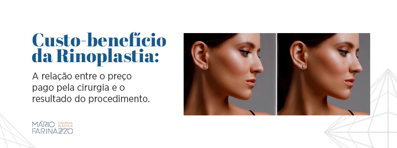 Custo-benefício da Rinoplastia: a relação entre o preço pago pela cirurgia e o resultado do procedimento.