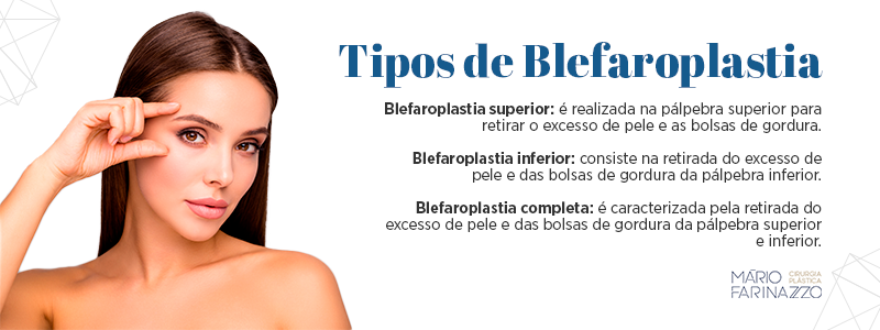 Tipos de blefaroplastia: Blefaroplastia superior: é realizada na pálpebra superior para retirar o excesso de pele e as bolsas de gordura. Blefaroplastia inferior: consiste na retirada do excesso de pele e das bolsas de gordura da pálpebra inferior. Blefaroplastia completa: é caracterizada pela retirada do excesso de pele e das bolsas de gordura da pálpebra superior e inferior.