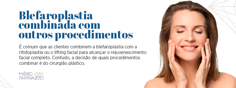 Blefaroplastia combinada com outros procedimentos. É comum que as clientes combinem a blefaroplastia com a ritidoplastia ou o lifting facial para alcançar o rejuvenescimento facial completo. Contudo, a decisão de quais procedimentos combinar é do cirurgião plástico. 