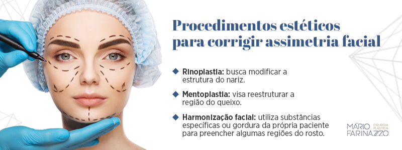 Procedimentos estéticos para corrigir assimetria facial. Rinoplastia: busca modificar a estrutura do nariz. Mentoplastia: visa reestruturar a região do queixo. Harmonização facial: utiliza substâncias específicas ou gordura da própria paciente para preencher algumas regiões do rosto.