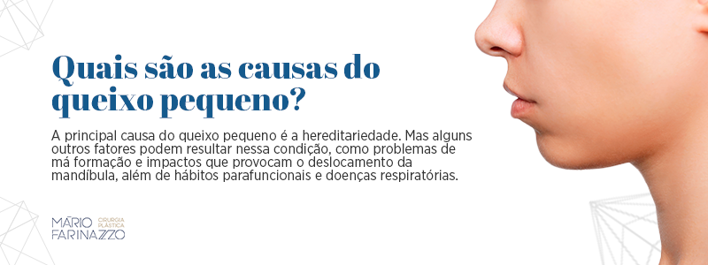 Quais são as causas do queixo pequeno? A principal causa do queixo pequeno é a hereditariedade. Mas alguns outros fatores podem resultar nessa condição, como problemas de má formação e impactos que provocam o deslocamento da mandíbula, além de hábitos parafuncionais e doenças respiratórias.