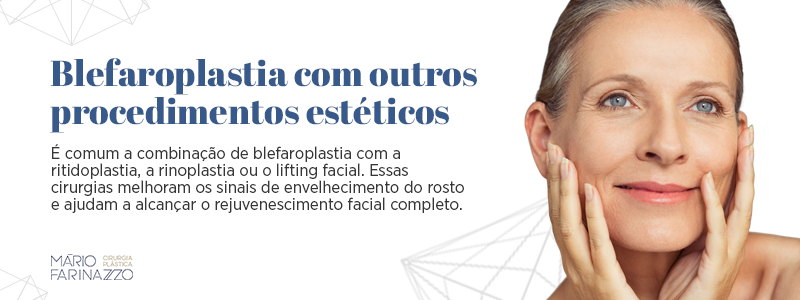 Blefaroplastia com outros procedimentos estéticos. É comum a combinação de blefaroplastia com a ritidoplastia, a rinoplastia ou o lifting facial. Essas cirurgias melhoram os sinais de envelhecimento do rosto e ajudam a alcançar o rejuvenescimento facial completo.