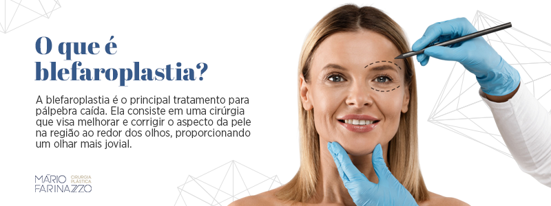 O que é blefaroplastia? A blefaroplastia é o principal tratamento para pálpebra caída. Ela consiste em uma cirurgia que visa melhorar e corrigir o aspecto da pele na região ao redor dos olhos, proporcionando um olhar mais jovial.
