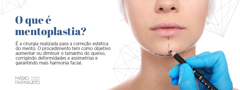 O que é mentoplastia? É a cirurgia realizada para a correção estética do mento. O procedimento tem como objetivo aumentar ou diminuir o tamanho do queixo, corrigindo deformidades e assimetrias e garantindo mais harmonia facial.