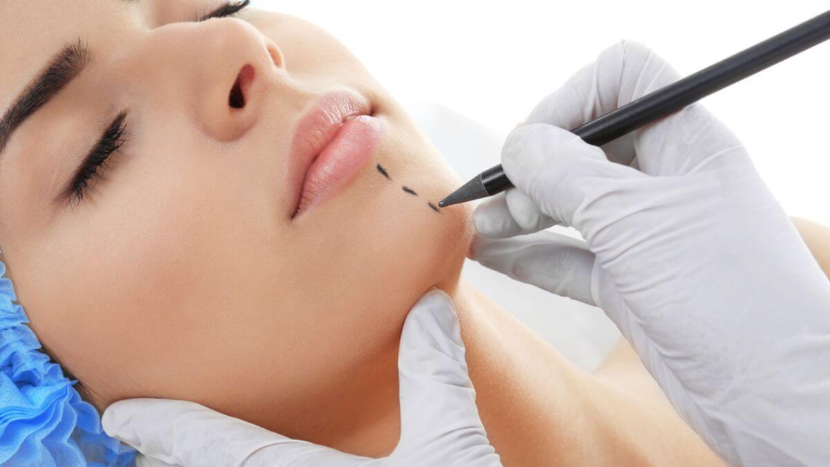 Implantes faciais: tudo sobre prótese de queixo