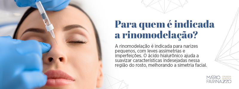 Para quem é indicada a rinomodelação?
A rinomodelação é indicada para narizes pequenos, com leves assimetrias e imperfeições. O ácido hialurônico ajuda a suavizar características indesejadas nessa região do rosto, melhorando a simetria facial.