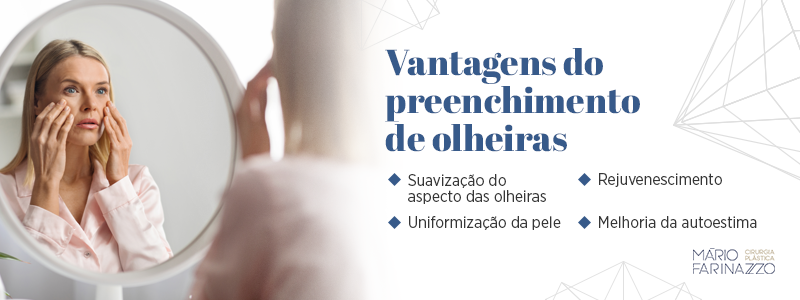 Vantagens do preenchimento de olheiras: suavização do aspecto das olheiras, uniformização da pele. rejuvenescimento e melhoria da autoestima.