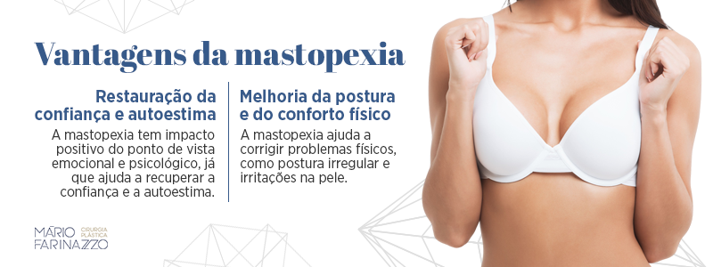 Vantagens da mastopexia. Restauração da confiança e autoestima: a mastopexia tem impacto positivo do ponto de vista emocional e psicológico, já que ajuda a recuperar a confiança e a autoestima. Melhoria da postura e do conforto físico: a mastopexia ajuda a corrigir problemas físicos, como postura irregular e irritações na pele.
