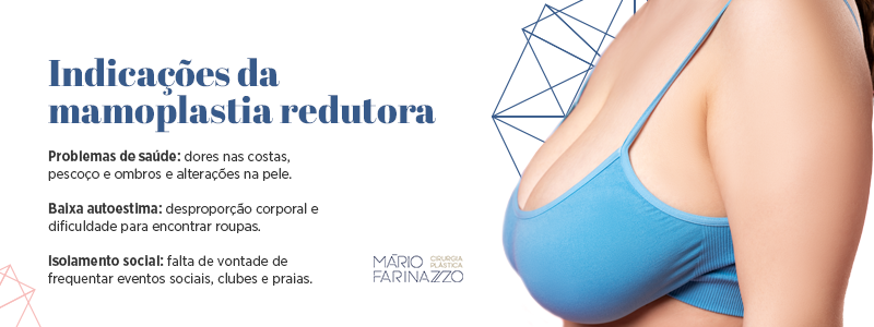 Indicações da mamoplastia redutora. Problemas de saúde: dores nas costas, pescoço e ombros e alterações na pele. Baixa autoestima: desproporção corporal e dificuldade para encontrar roupas. Isolamento social: falta de vontade de frequentar eventos sociais, clubes e praias.
