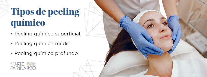 Tipos de peeling químico: peeling químico superficial,
peeling químico médio e peeling químico profundo.