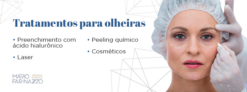Tratamentos para olheiras: preenchimento com ácido hialurônico, laser, peeling químico e cosméticos.