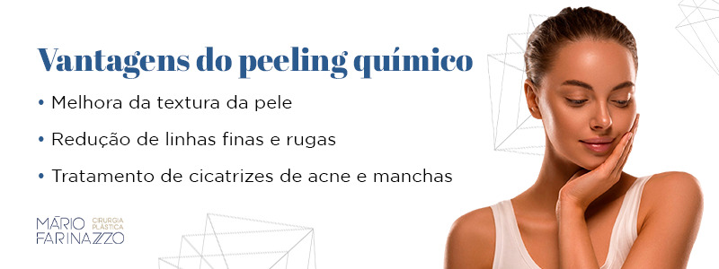 Vantagens do peeling químico: melhora da textura da pele, redução de linhas finas e rugas
e tratamento de cicatrizes de acne e manchas.