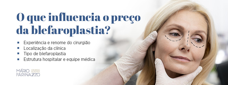 O que influencia o preço da blefaroplastia? Experiência e renome do cirurgião, localização da clínica, tipo de blefaroplastia, estrutura hospitalar e equipe médica.
