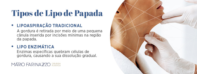 Tipos de lipo de papada. Lipoaspiração tradicional: a gordura é retirada por meio de uma pequena cânula inserida por incisões mínimas na região da papada. Lipo enzimática: enzimas específicas quebram células de gordura, causando a sua dissolução gradual.