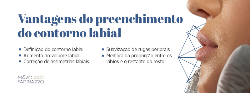 Vantagens do preenchimento do contorno labial: Definição do contorno labial, aumento do volume labial, correção de assimetrias labiais, suavização de rugas periorais e melhora da proporção entre os lábios e o restante do rosto.