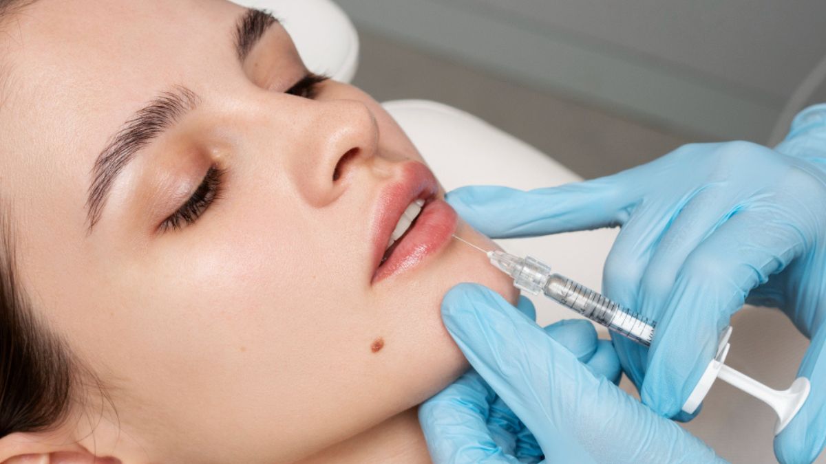 Para que serve o preenchimento do contorno labial?