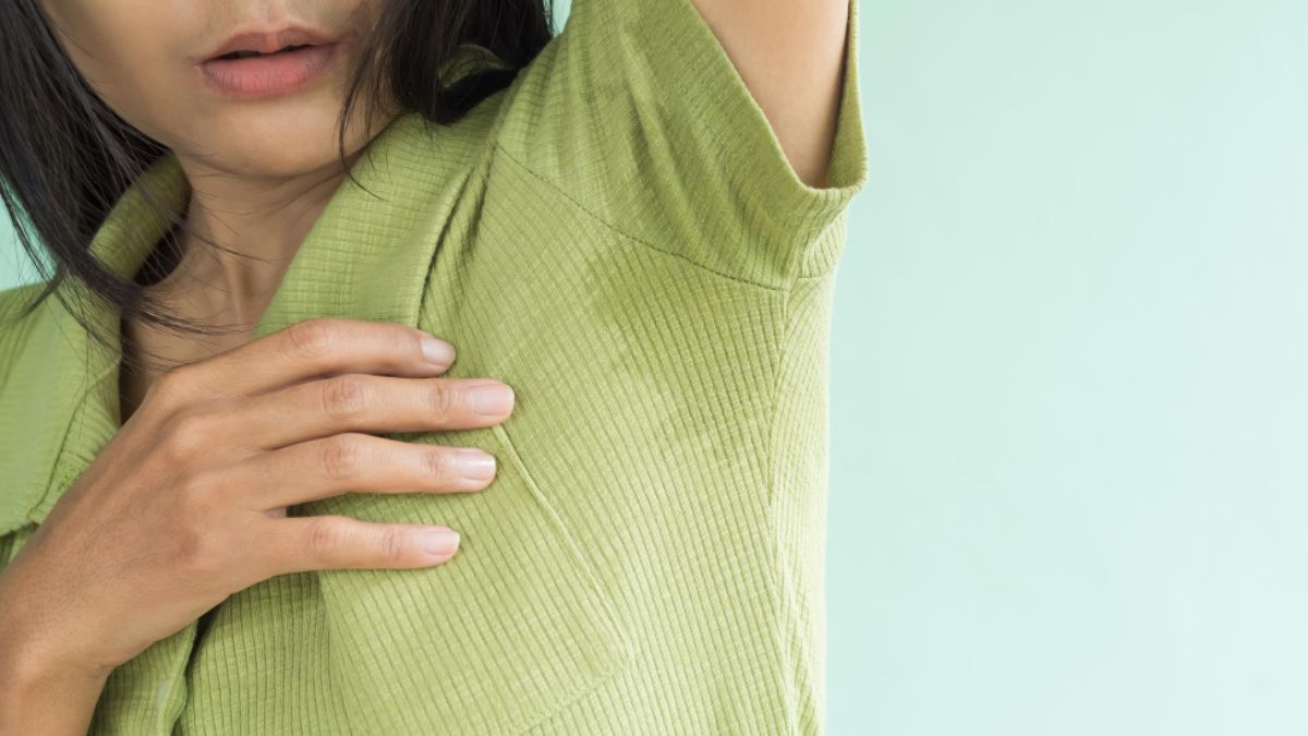 Suor excessivo nas axilas: como acabar com esse problema?​