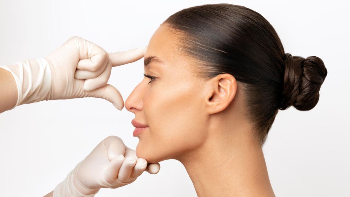 Rinoplastia aberta: saiba como é feita